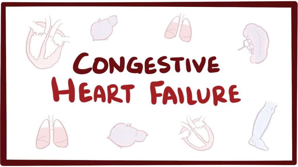 An overview about cognitive heart failure